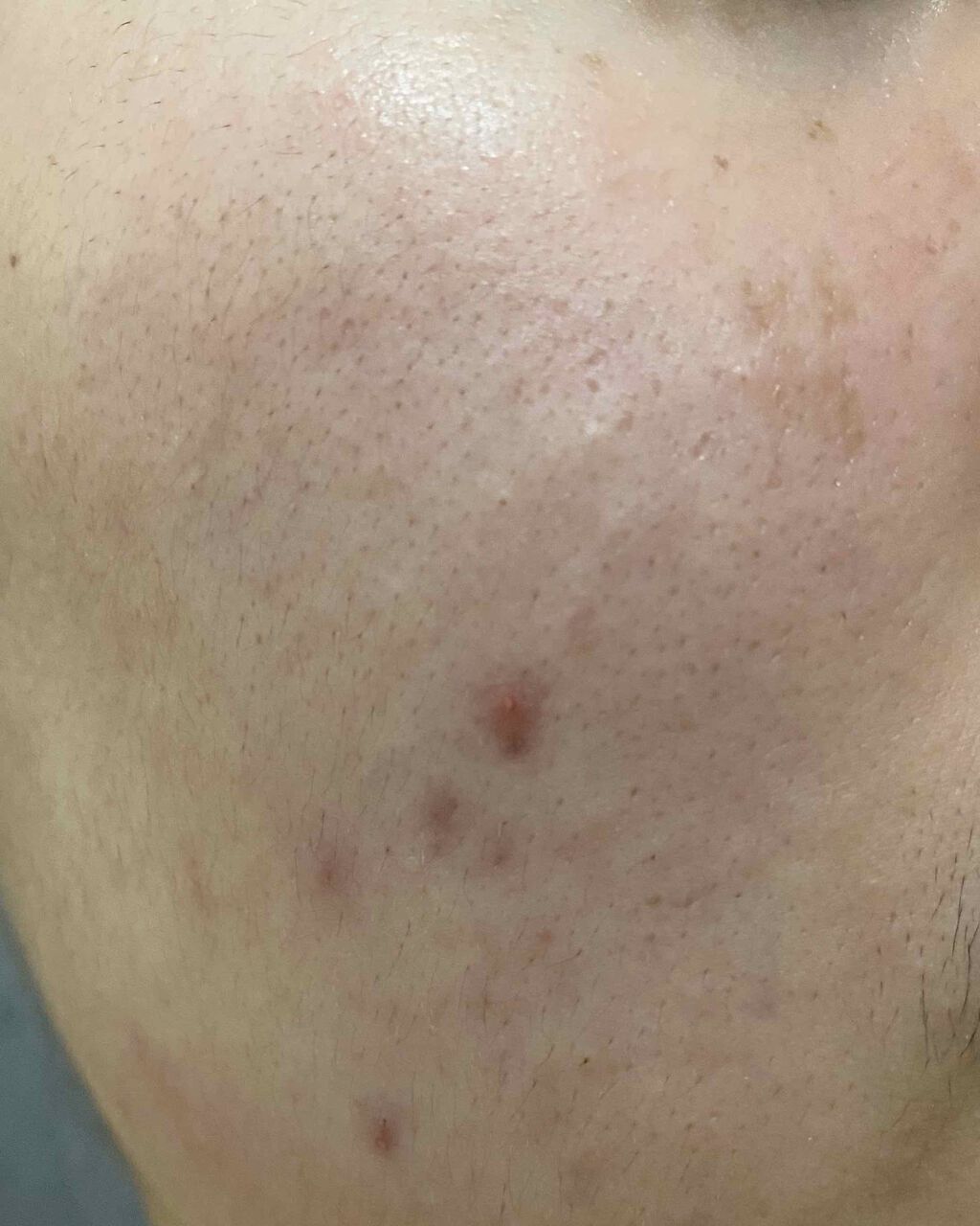 プレミアムフェイスマスクPT/マイオーガニー/シートマスク・パックを使ったクチコミ（2枚目）