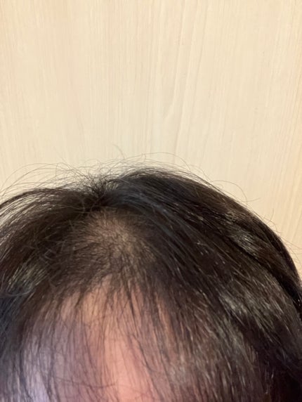 シャンプー/コンディショナー 根元からふんわり/セグレタ/市販シャンプーを使ったクチコミ(8枚目)