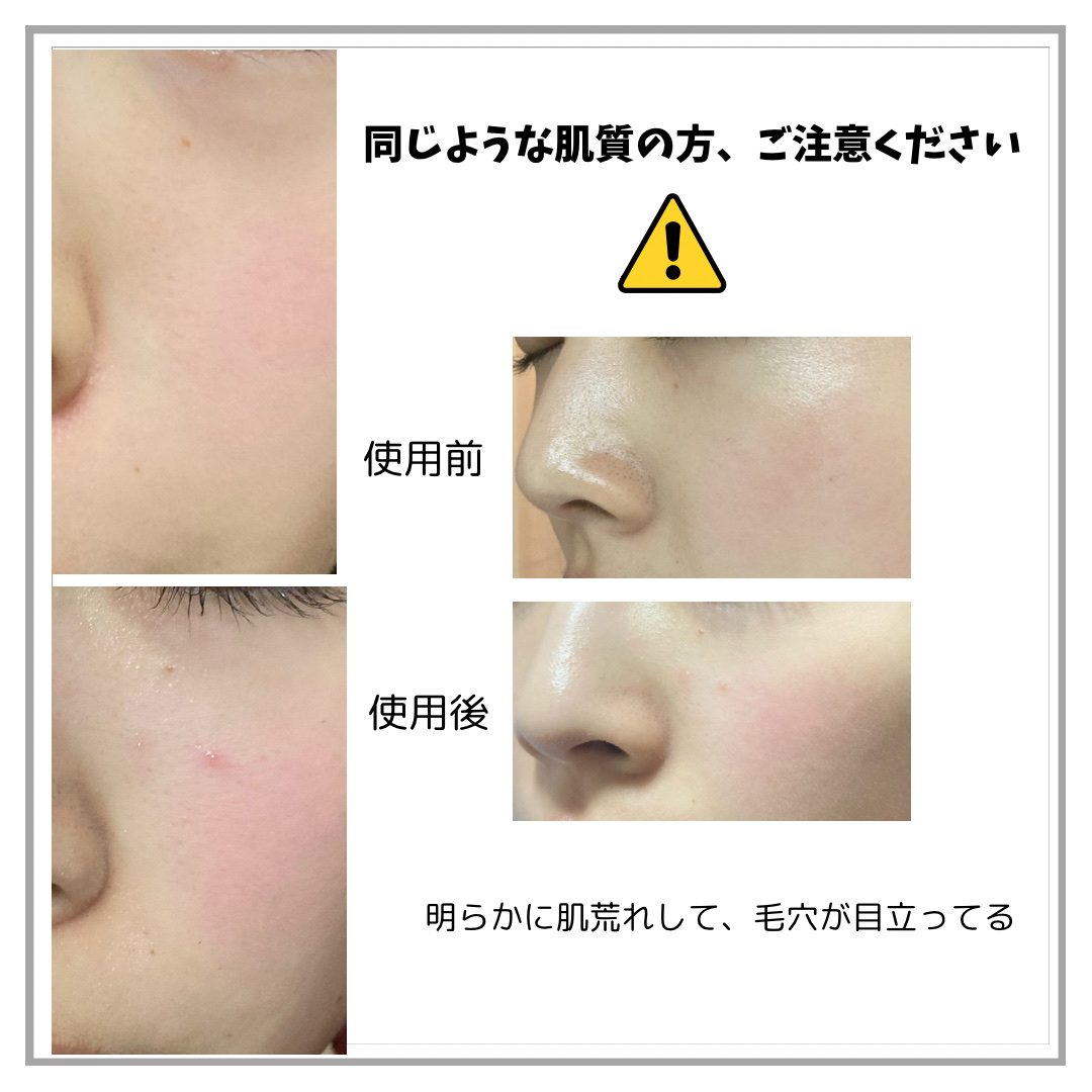 リードルショット100/VT/美容液を使ったクチコミ（3枚目）