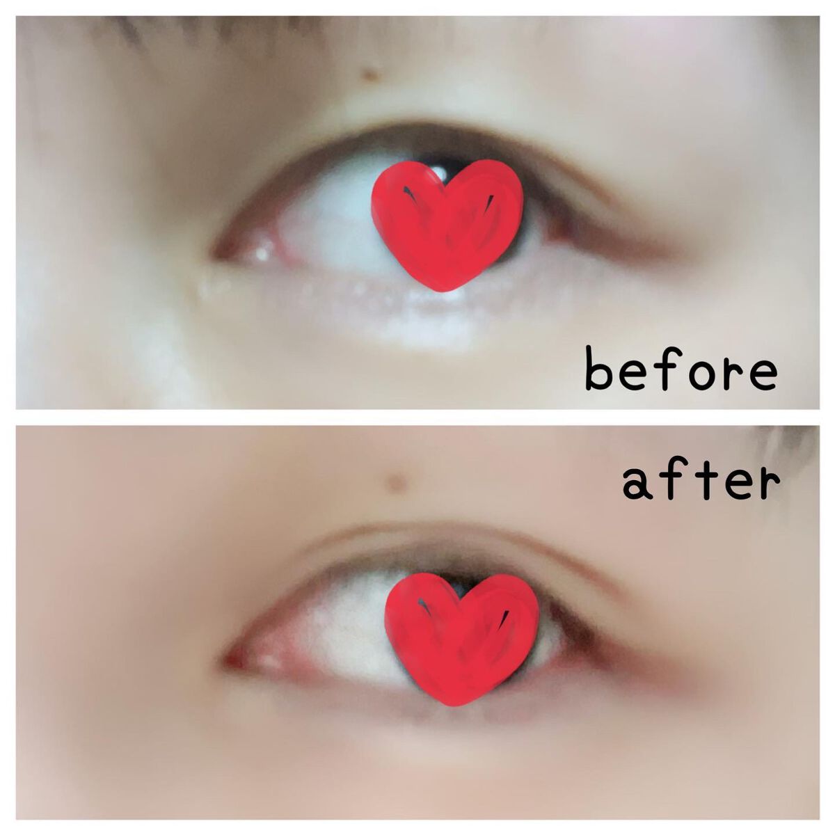 マイクロファイバー /ビー・エヌ/二重まぶた用アイテムを使ったクチコミ(6枚目)