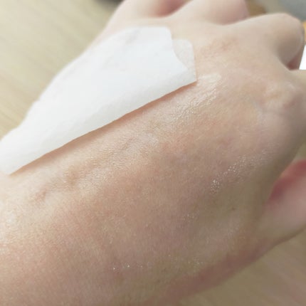 センテラ クイックカーミングパッド/SKIN1004/トナーパッドを使ったクチコミ(4枚目)