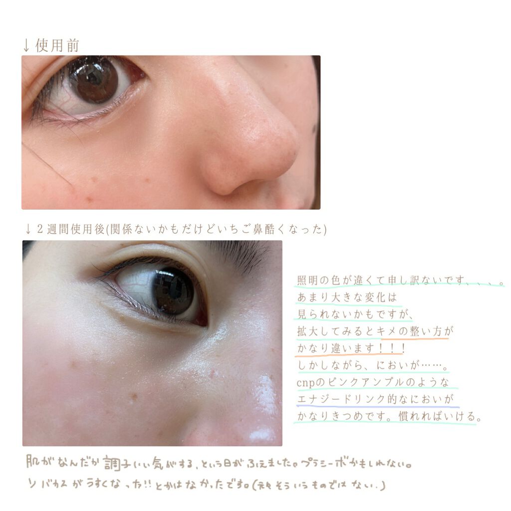 オバジC10セラム/オバジ/美容液を使ったクチコミ（2枚目）