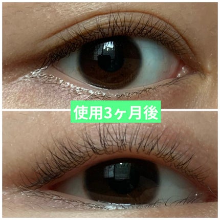 スカルプD ボーテ ピュアフリーアイラッシュセラム/アンファー(スカルプD)/まつげ美容液を使ったクチコミ(2枚目)