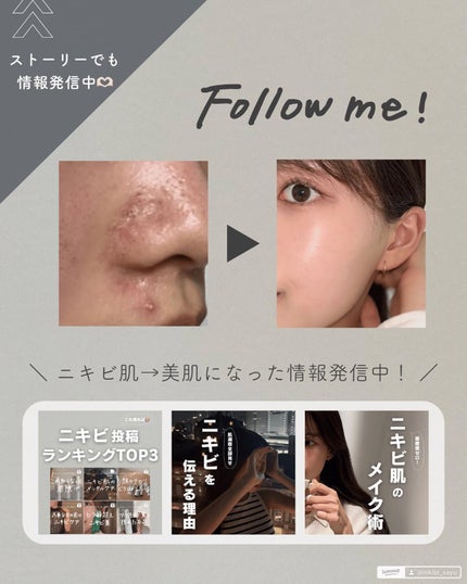 白湯(サユ) | ニキビと戦うOL🤍 on LIPS 「.アンケートでも反応がたくさんあったトナーパッド! 韓国発のア..」(7枚目)