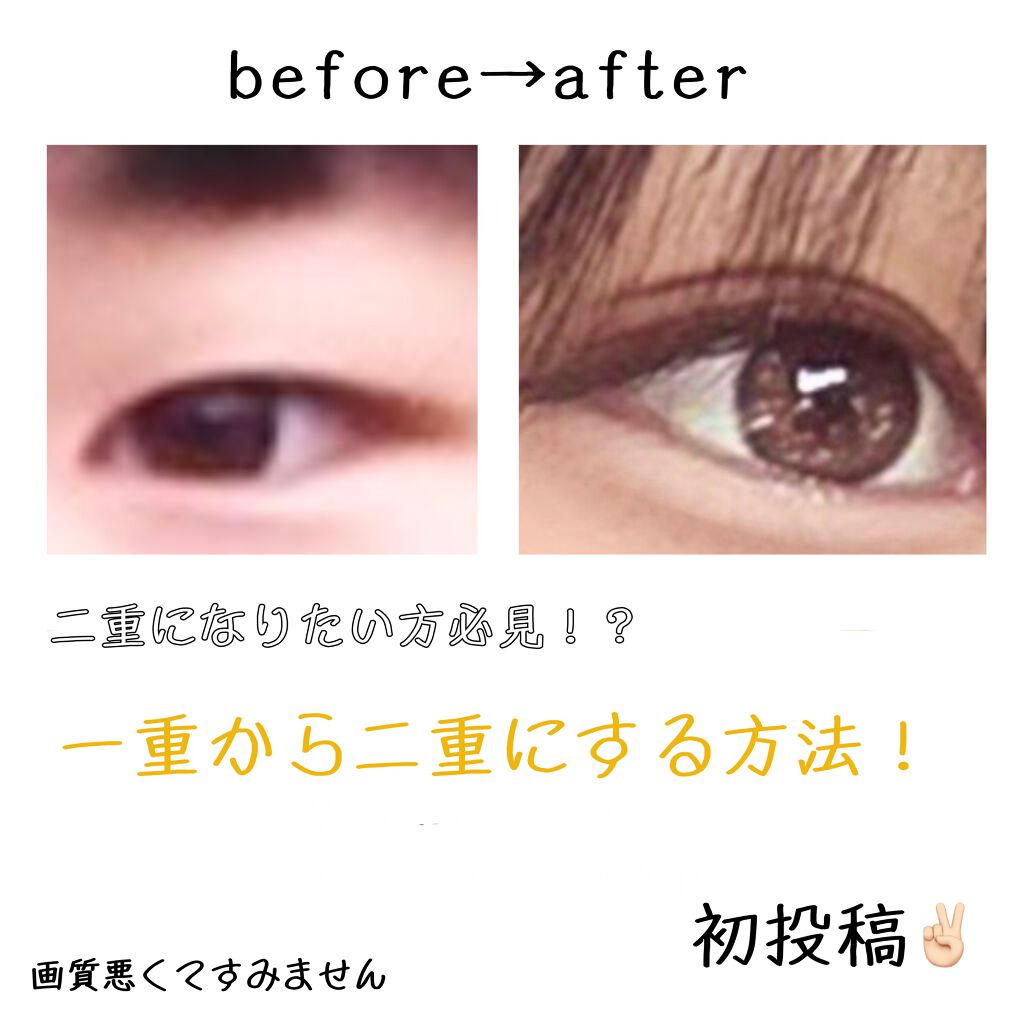 シングルアイテープ/Automatic Beauty/二重まぶた用アイテムを使ったクチコミ（1枚目）