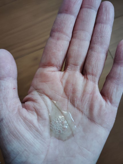 アゼライン酸15 インテンスカーミングセラム/Anua/美容液を使ったクチコミ(2枚目)