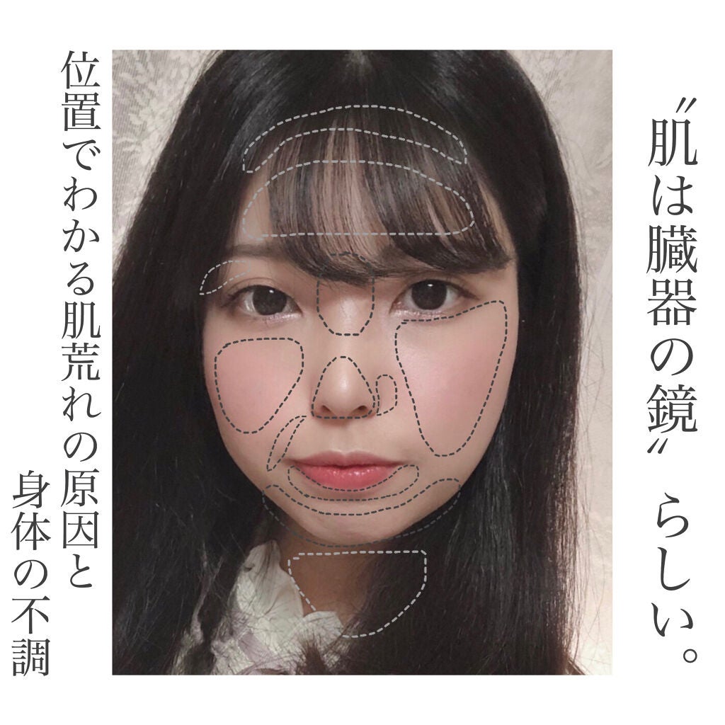 インテンシブ エキナセアクリーム/ARGITAL/フェイスクリームを使ったクチコミ(1枚目)