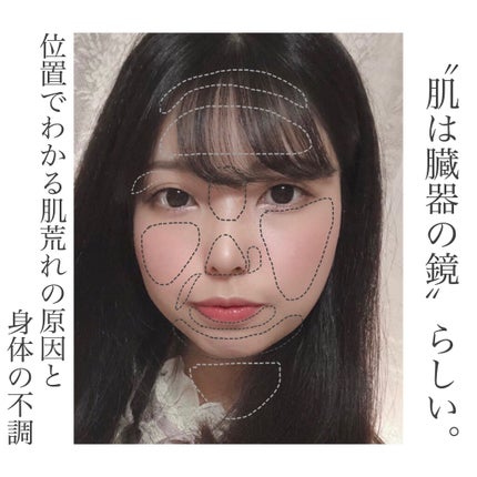 インテンシブ エキナセアクリーム/ARGITAL/フェイスクリームを使ったクチコミ(1枚目)