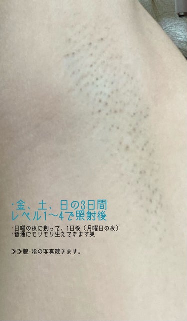 愛用 アイスレディ|iceladyの効果に関する口コミ「⭐アイスレディー