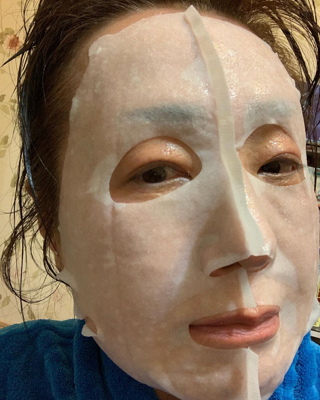 モイストフェイシャルパック/リバイシス/シートマスク・パックを使ったクチコミ（2枚目）