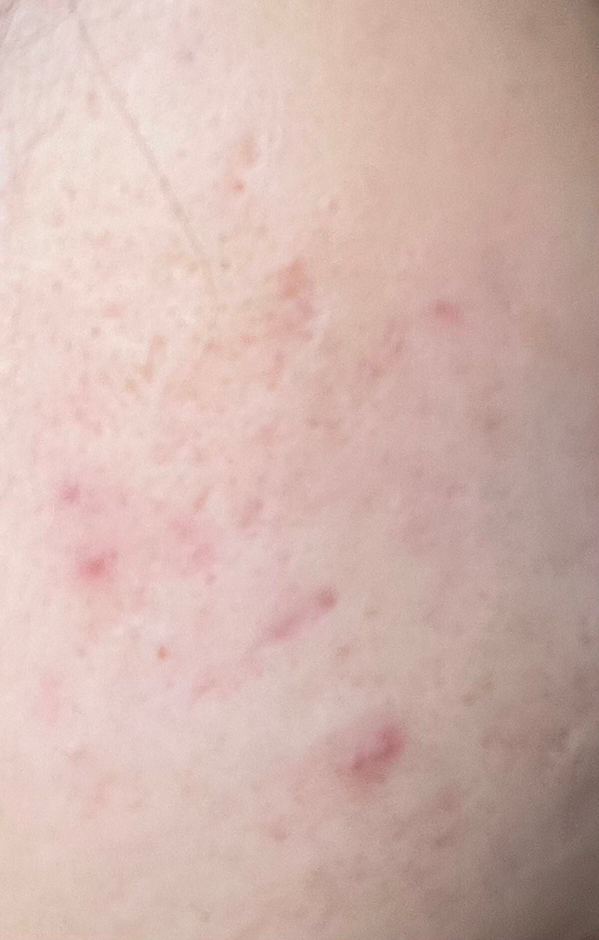 薬用ホワイトセラム/フェアルーセント/美容液を使ったクチコミ(2枚目)