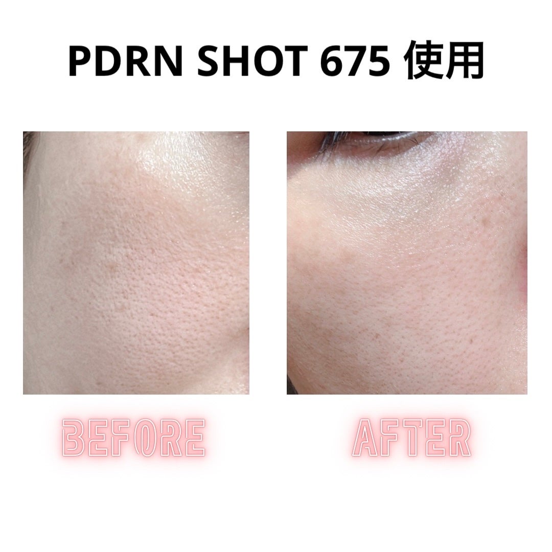 パンテショット675/COSNORI/美容液を使ったクチコミ(6枚目)