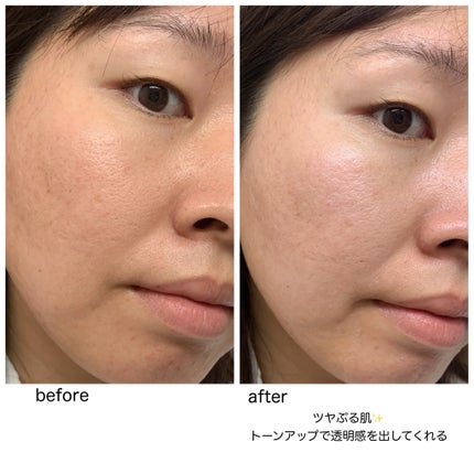 ããªã¬UVãã¢ã¯ã¢ãªãããã¢ã¯ã¢ãã€ã©ã€ãããŒã·ã§ã³ïŒæ°Žå±€ãã€ã©ã€ãUVïŒ/ããªã¬/æ¥çŒãæ¢ãããŒã·ã§ã³ã䜿ã£ãã¯ãã³ãïŒ9æç®ïŒ