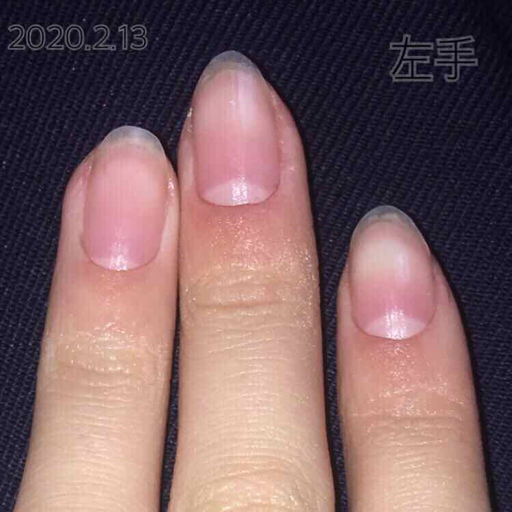 エテュセ クイックケアコート/ettusais/ネイルオイル・トリートメントを使ったクチコミ（3枚目）