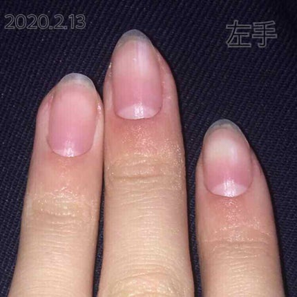 エテュセ クイックケアコート/ettusais/ネイルオイル・トリートメントを使ったクチコミ(3枚目)