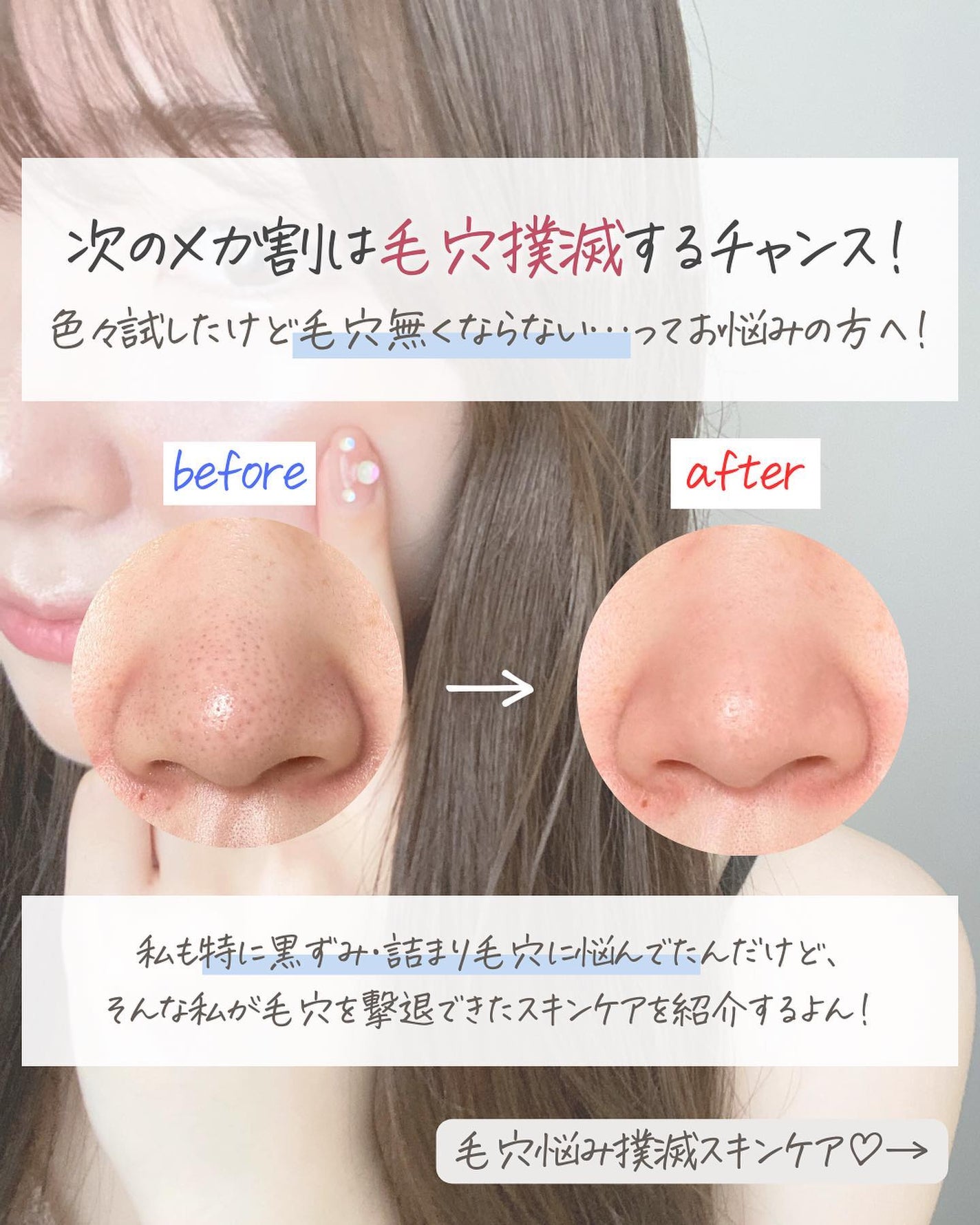 らな ♡ 韓国スキンケア / 韓国コスメ on LIPS 「優しいピーリングで角質・毛穴ケア🤍/DR.WUの美容液を紹介す..」(2枚目)