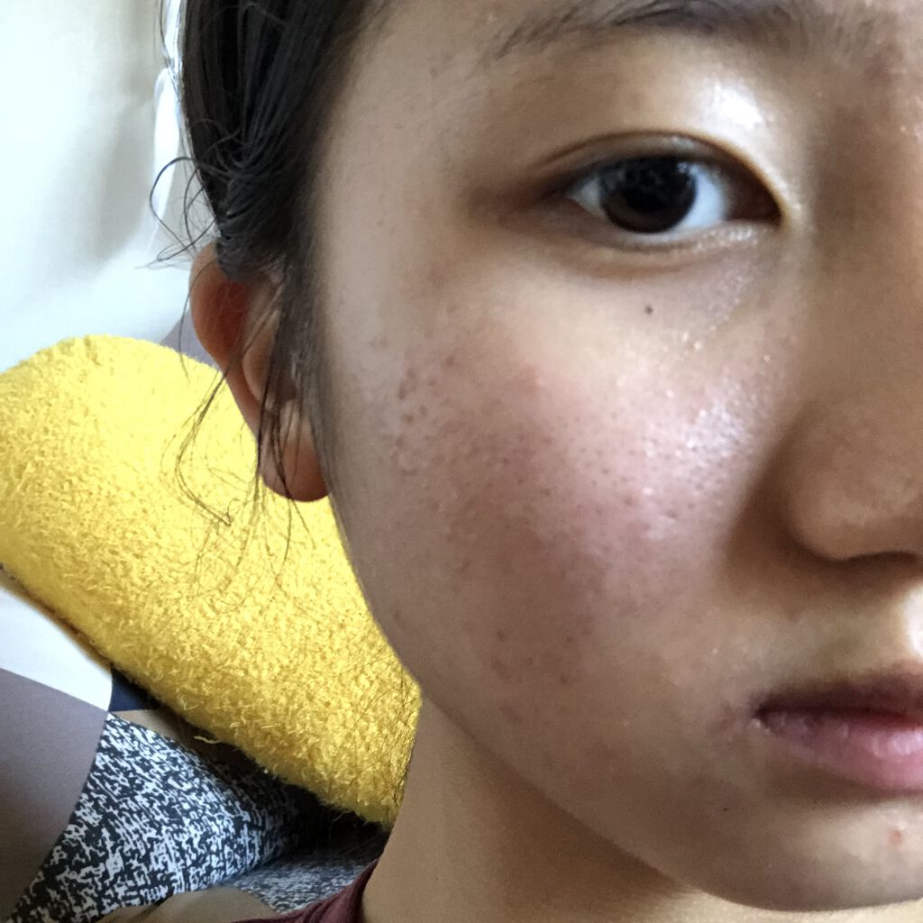 潤い化粧水/ももぷり/化粧水を使ったクチコミ（2枚目）