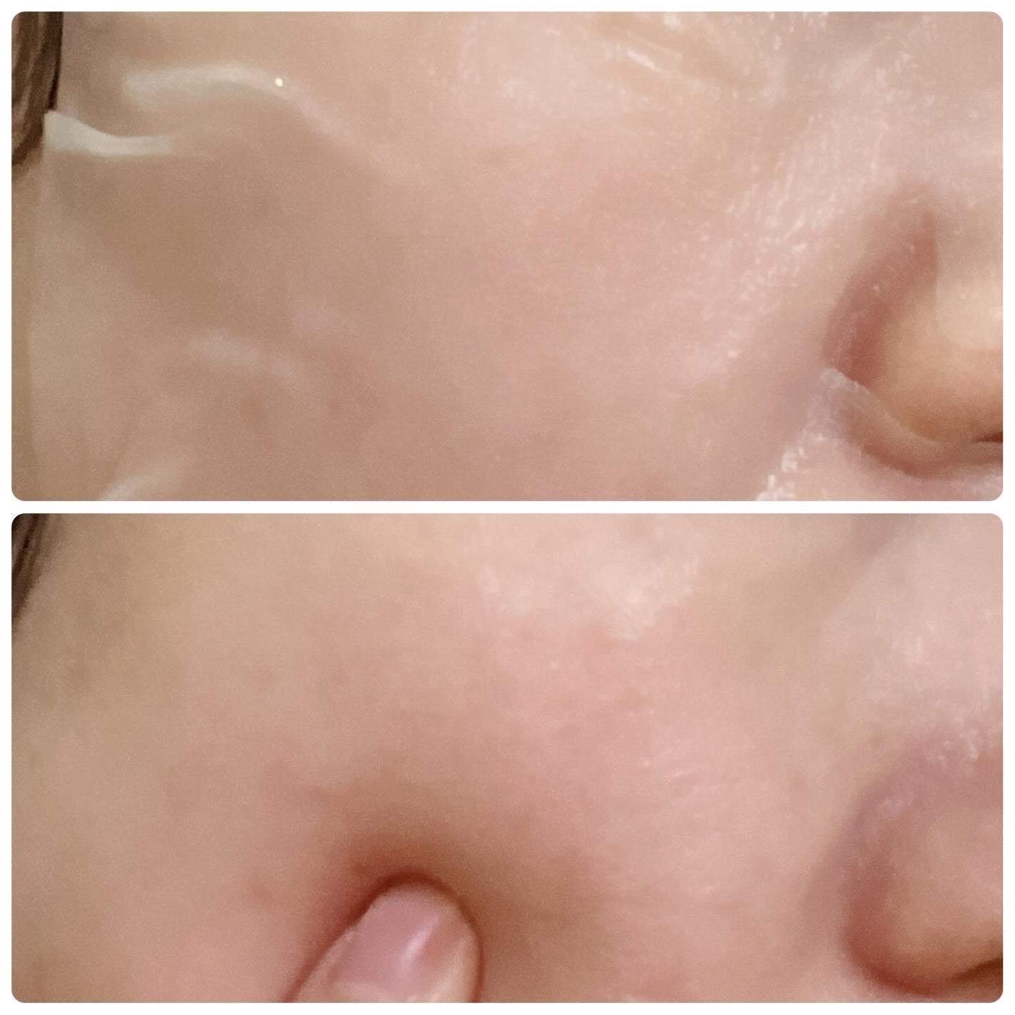 レッドブレミッシュ クールスージングマスク/Dr.G/シートマスク・パックを使ったクチコミ(7枚目)