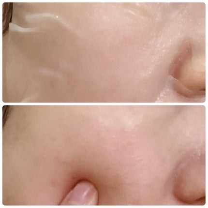 レッドブレミッシュ クールスージングマスク/Dr.G/シートマスク・パックを使ったクチコミ(7枚目)