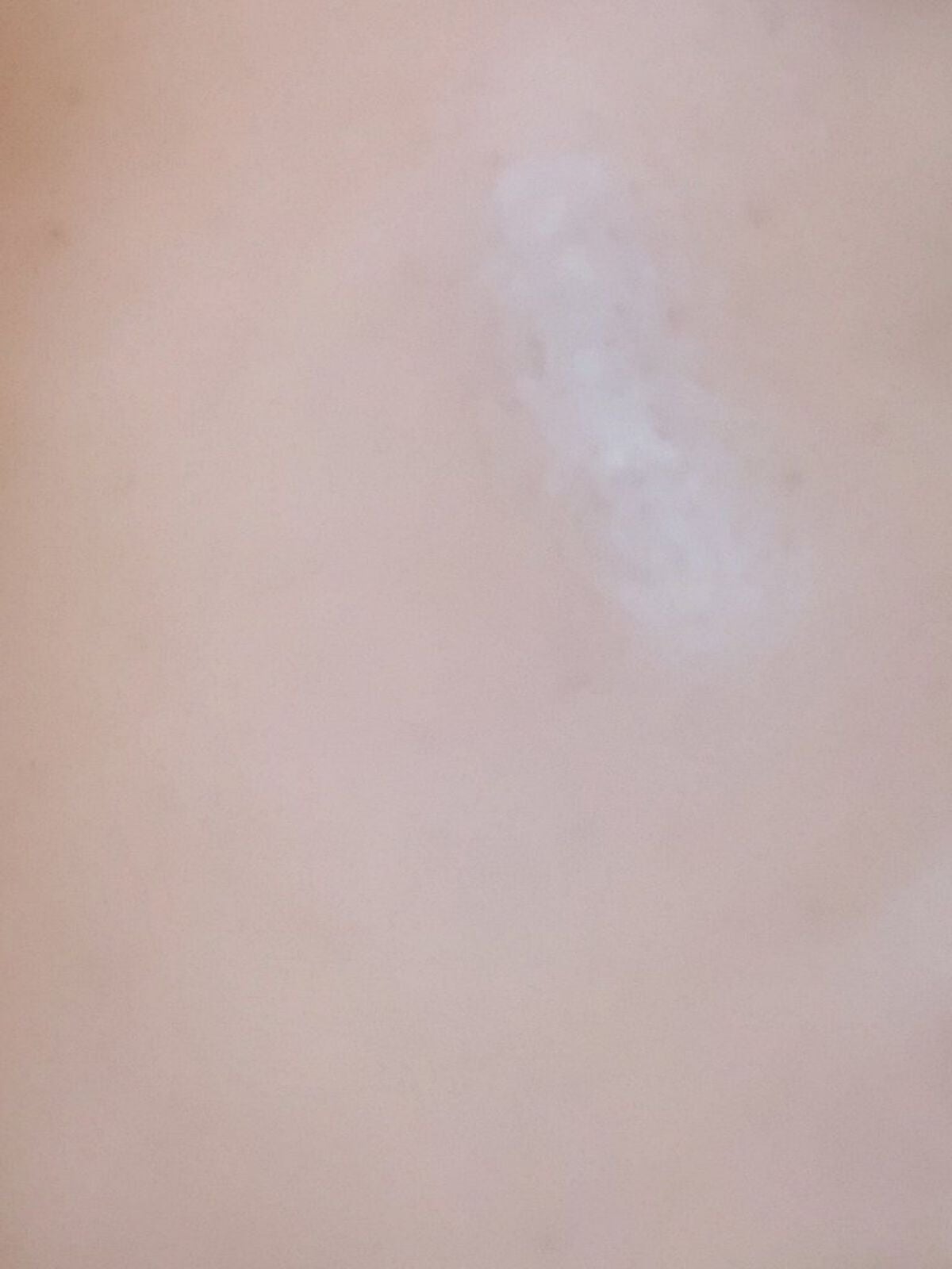 薬用しみ対策 美白化粧水/メラノCC/化粧水を使ったクチコミ(3枚目)