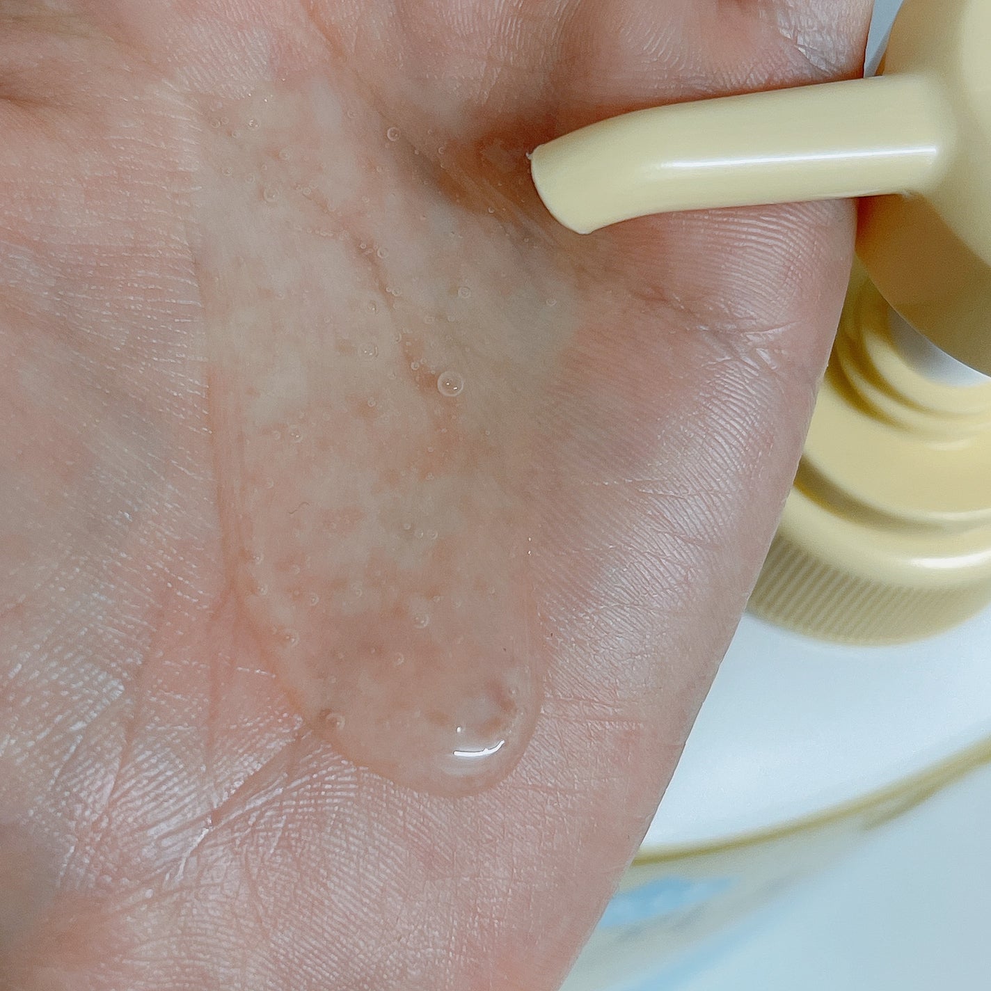 アレルジーナ 抗ヒスタミン成分配合ボディソープ/マックス/ボディソープを使ったクチコミ(2枚目)