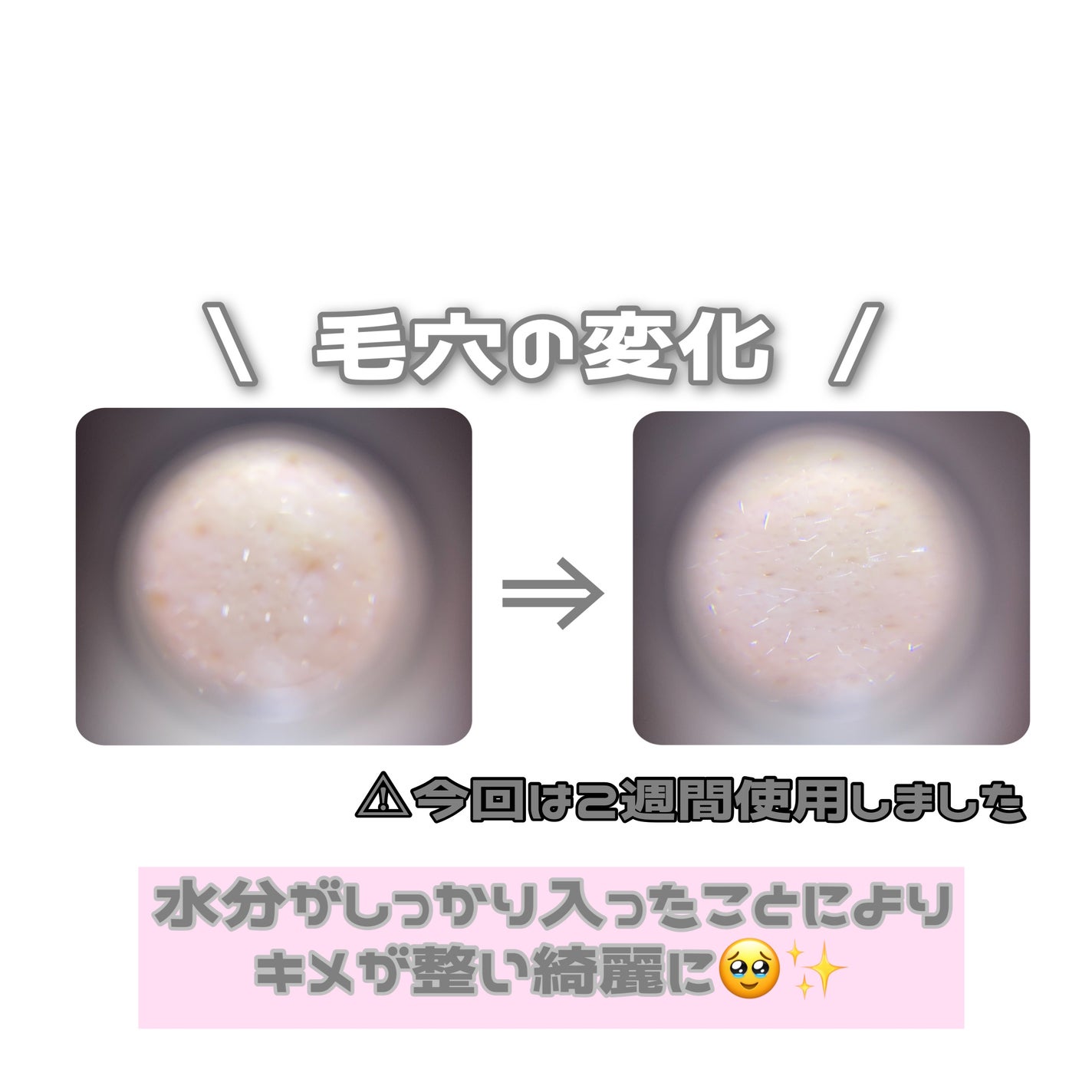 リードルショット300/VT/美容液を使ったクチコミ(5枚目)