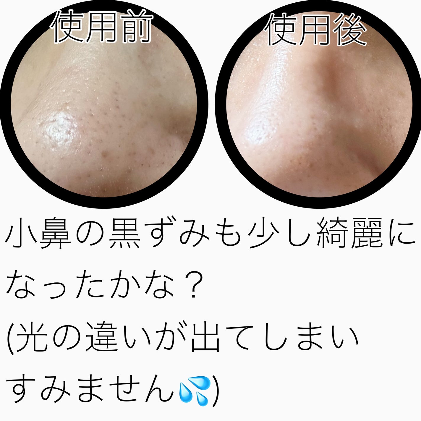 イチジク毛穴アンプル/Veganifect/美容液を使ったクチコミ(5枚目)