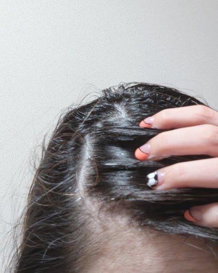 ナノグロウリッチ/iqumore/頭皮ローションを使ったクチコミ(5枚目)