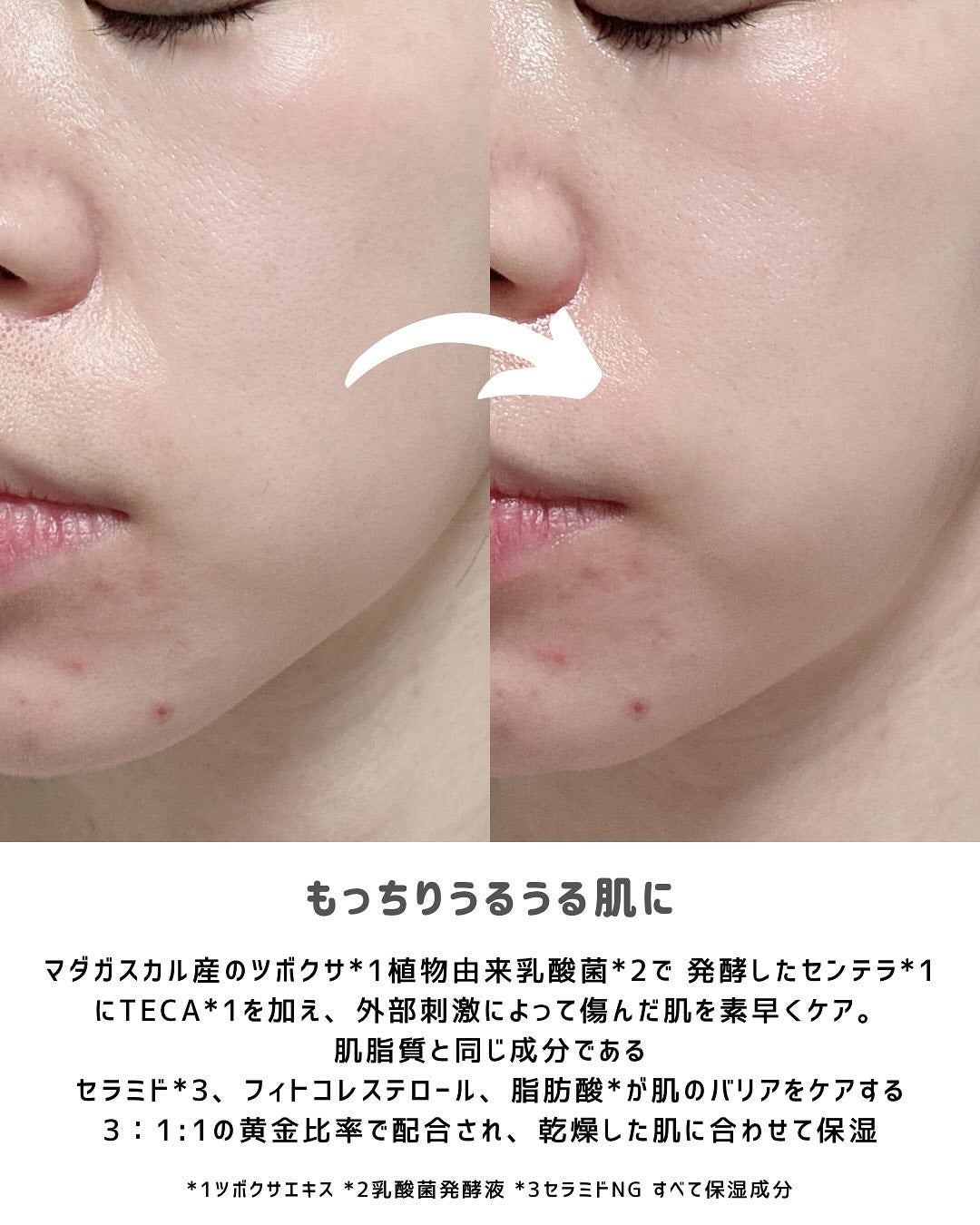 プロバイオシカ インテンシブ アンプル/SKIN1004/美容液を使ったクチコミ(4枚目)