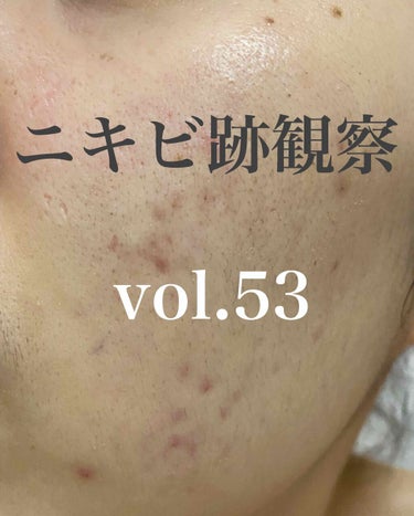 敏感肌用薬用美白美容液/無印良品/美容液を使ったクチコミ（1枚目）