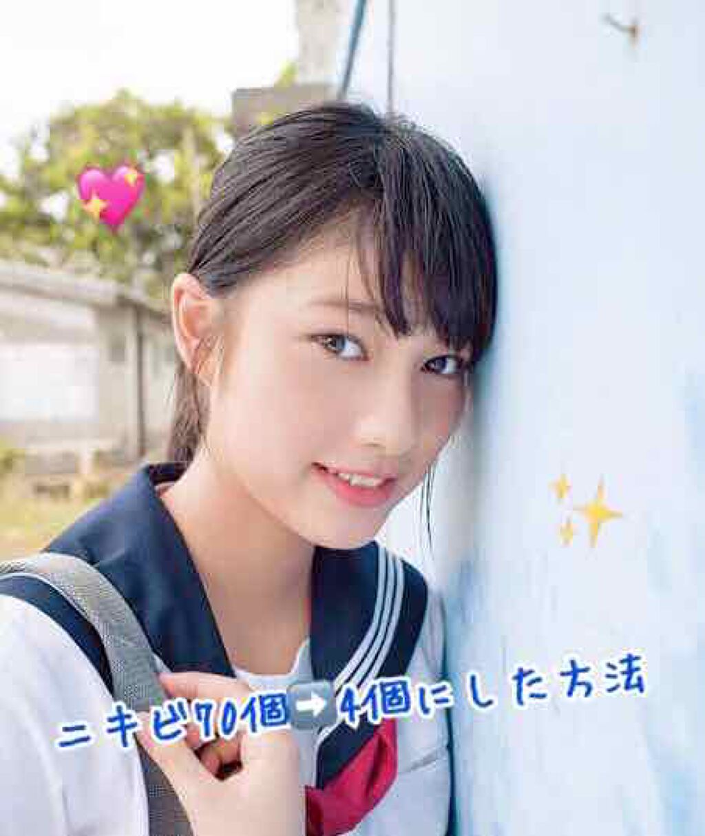 テラ・コートリル 軟膏(医薬品)/ジョンソン・エンド・ジョンソン/その他を使ったクチコミ（1枚目）