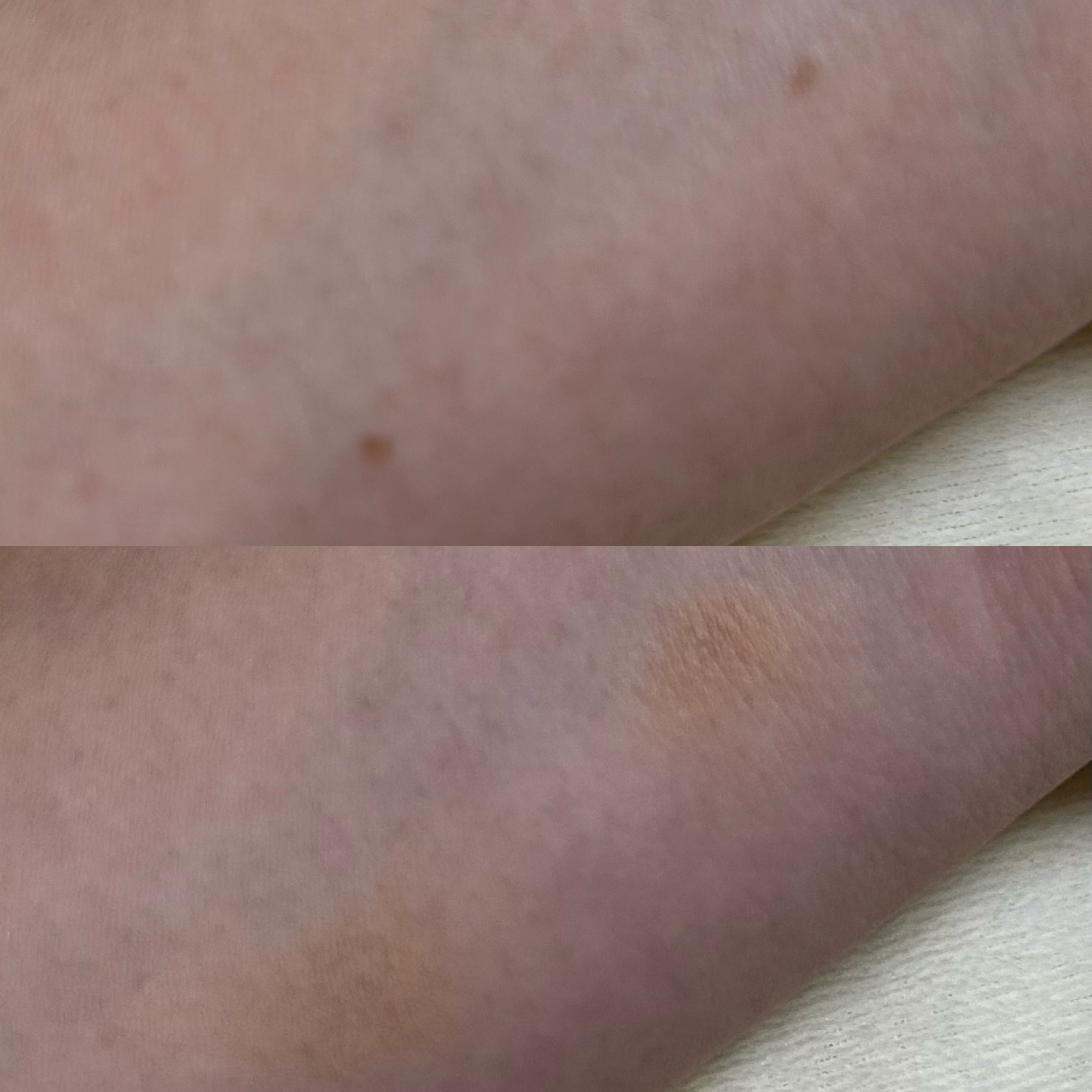 スポッツカバー ファウンデイション （ベースカラー）H100/SHISEIDO/クリームコンシーラーを使ったクチコミ（3枚目）