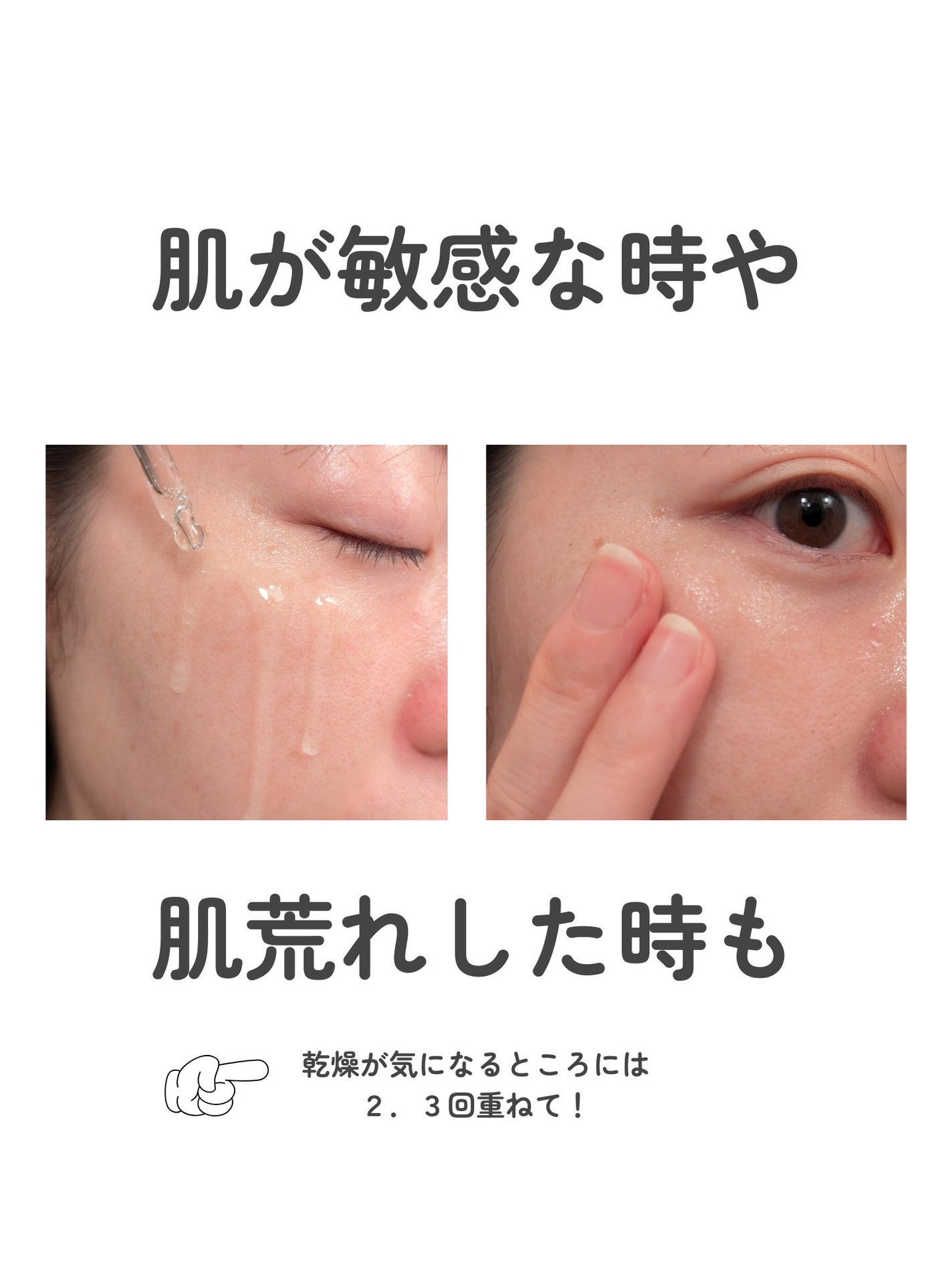 ノスカナイン トラブル セラム/FATION/美容液を使ったクチコミ(4枚目)