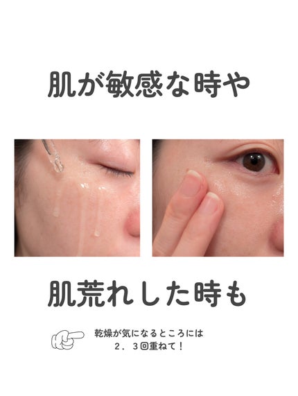 ノスカナイン トラブル セラム/FATION/美容液を使ったクチコミ(4枚目)