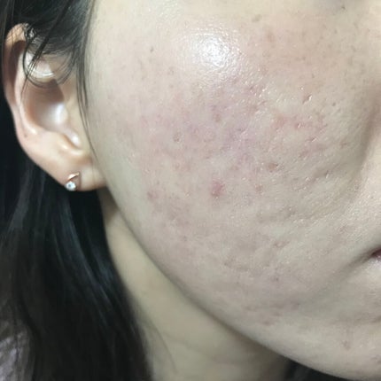 ゼン ウェア フルイド/DECORTÉ/リキッドファンデーションを使ったクチコミ(4枚目)