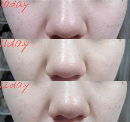 沖縄もずくのクレンジング ネオ*ちゅらびはだ/チュラコス/クレンジングジェルを使ったクチコミ(5枚目)