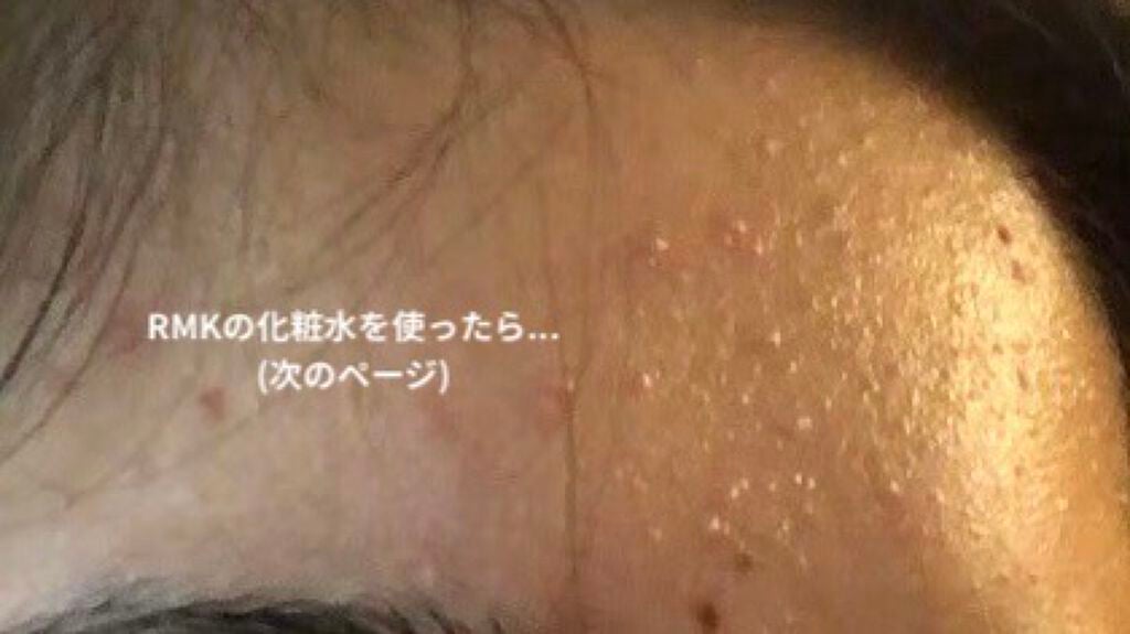 バランス スキンコンディショナー/RMK/化粧水を使ったクチコミ(3枚目)
