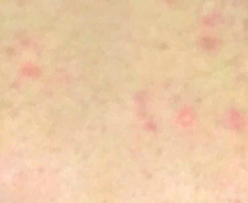 化粧水 敏感肌用 さっぱりタイプ/無印良品/化粧水を使ったクチコミ(2枚目)