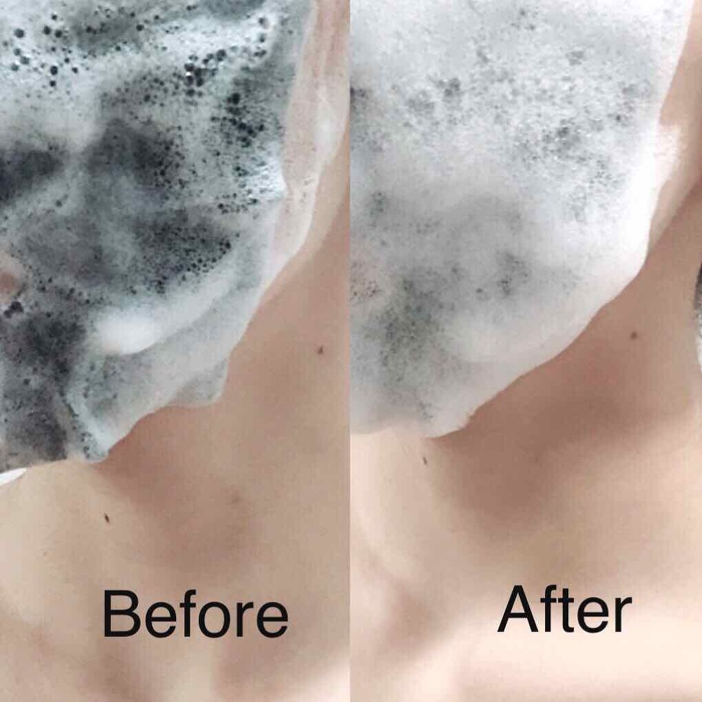 炭酸バブルシート/MEDIHEAL/シートマスク・パックを使ったクチコミ（3枚目）