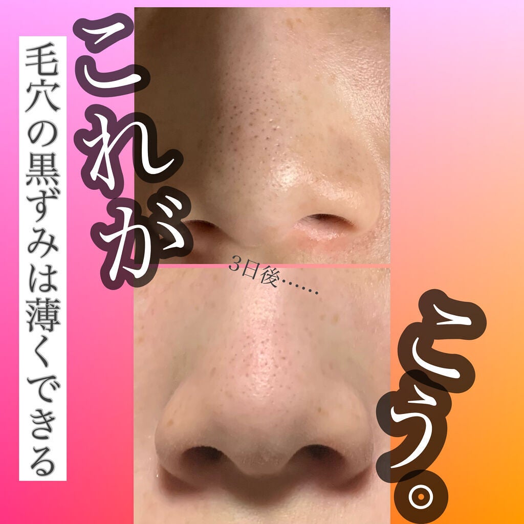 パワーマスク SP/ラッシュ/スクラブ・ゴマージュを使ったクチコミ(1枚目)