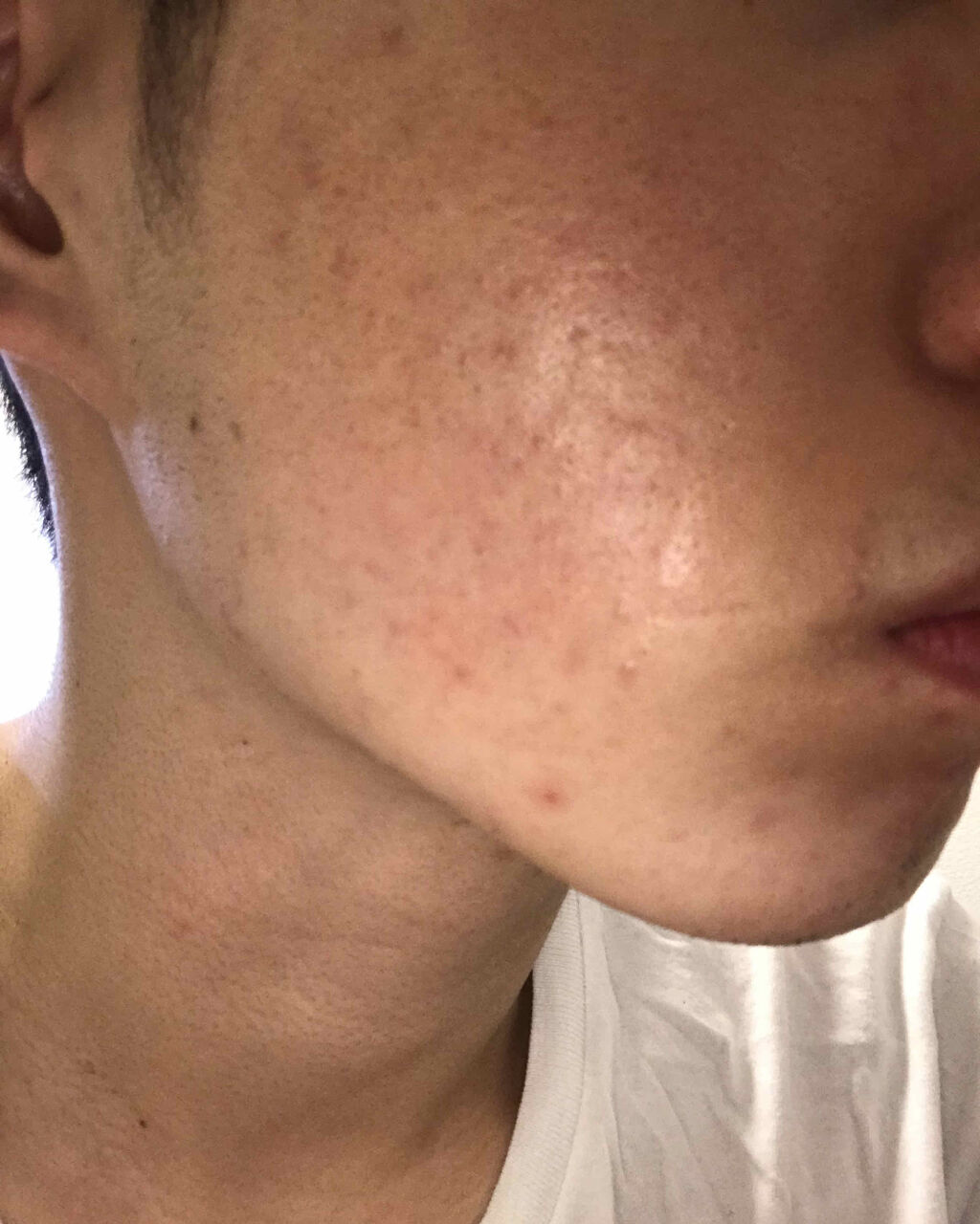 ロゼット 洗顔パスタ ガスールブライト/ロゼット/洗顔フォームを使ったクチコミ（1枚目）