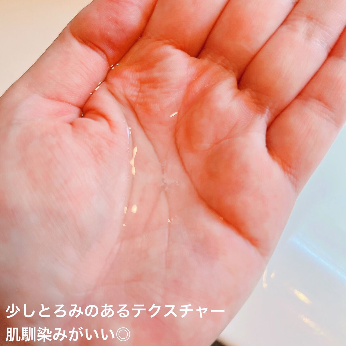 薬用マイクロバブルローション/Macchia Label/化粧水を使ったクチコミ(4枚目)