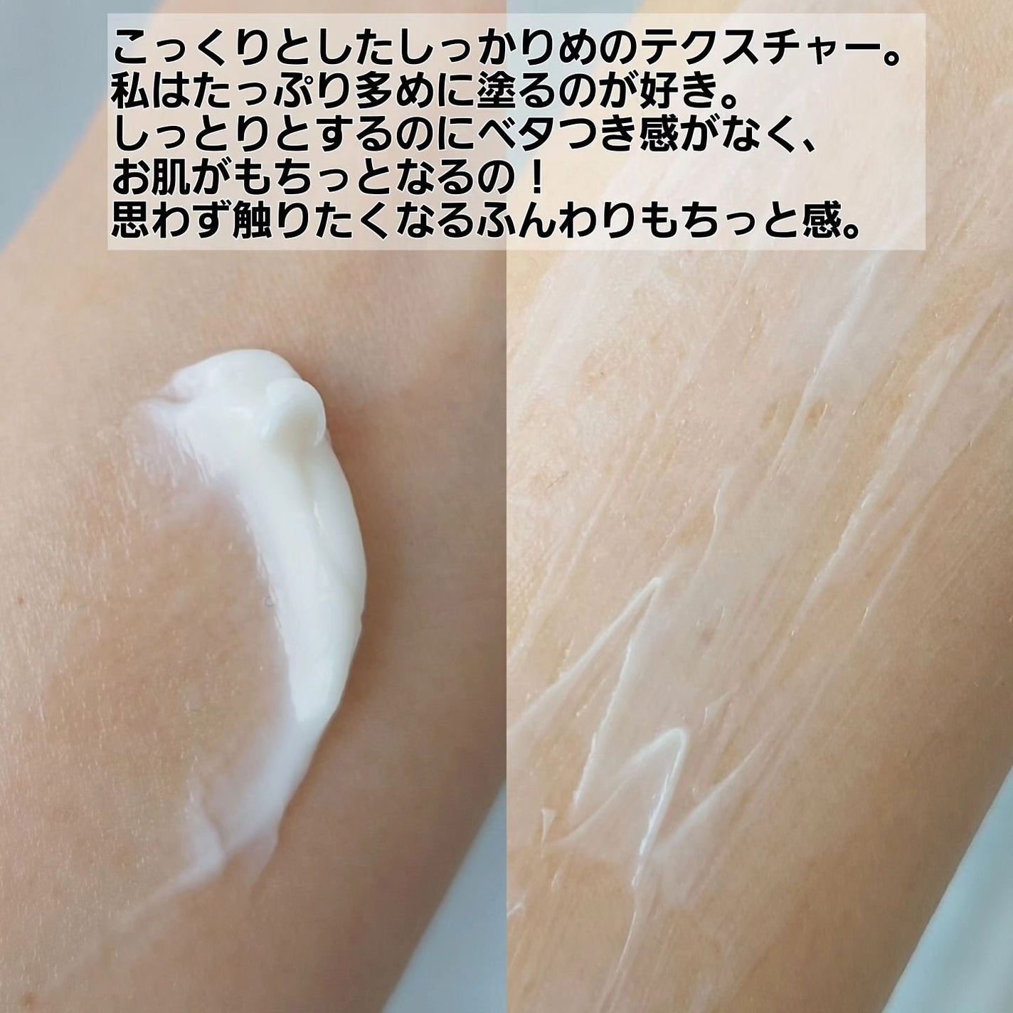 ブラックスネイル クリーム/Dr.G/フェイスクリームを使ったクチコミ(4枚目)