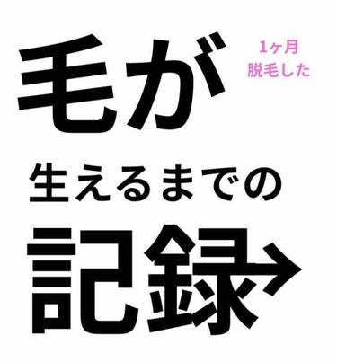 アイスレディ/icelady/家庭用脱毛器を使ったクチコミ（1枚目）