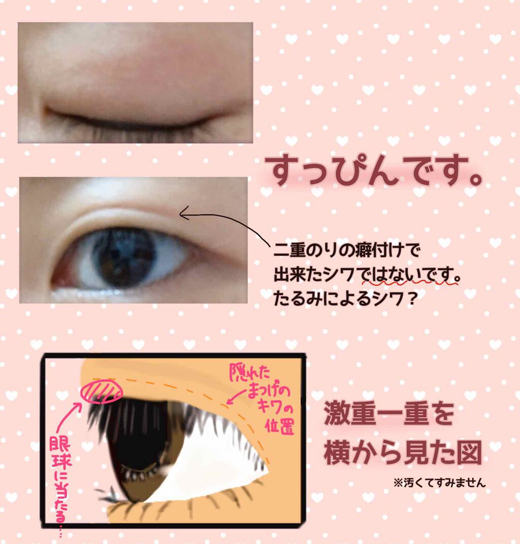 ワンダーアイリッドテープ Mild/D-UP/二重まぶた用アイテムを使ったクチコミ(2枚目)