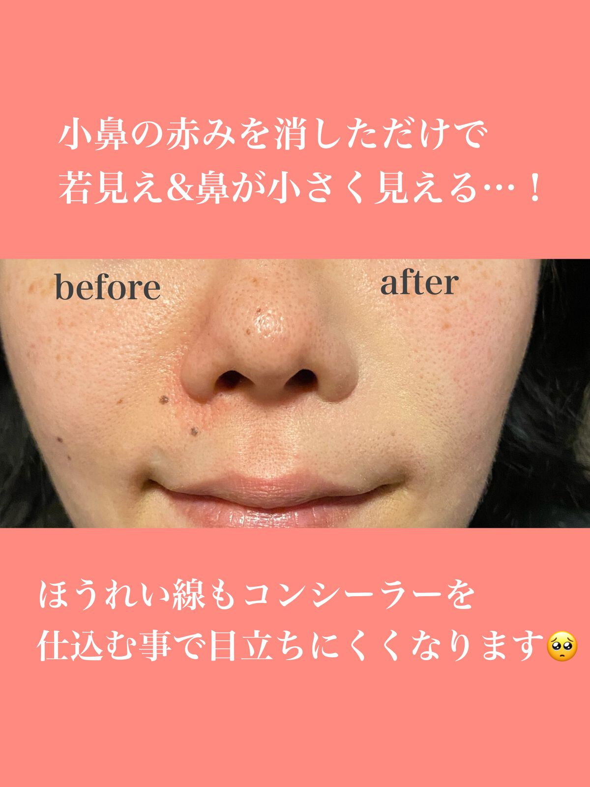 スーパーベーシック リクイドコンシーラー N/RMK/リキッドコンシーラーを使ったクチコミ(6枚目)