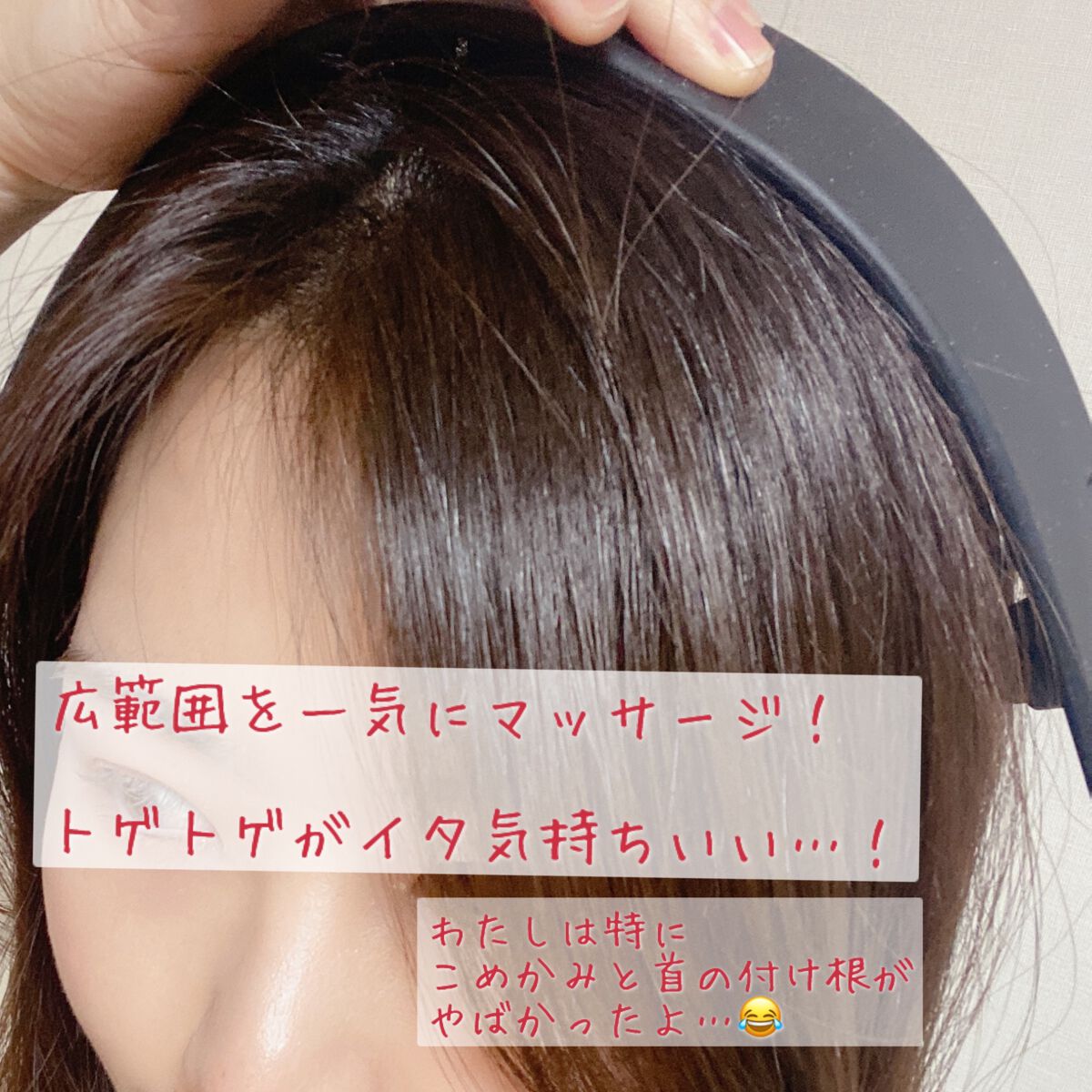 カクタスバンド/イエスパ/ツボ押し・マッサージグッズを使ったクチコミ(2枚目)