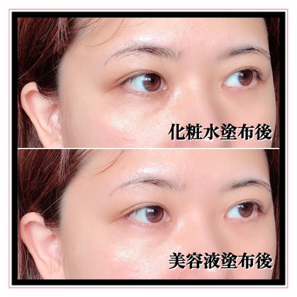 グルタチオングロウアンプル/MEDICUBE/美容液を使ったクチコミ(9枚目)