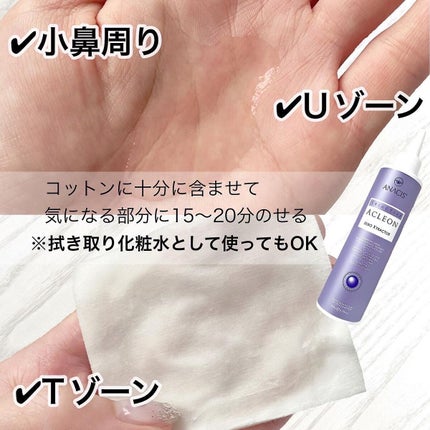 ã¢ã¯ã¬ãªã³ã»ããšã¯ã¹ãã©ã¯ã¿ãŒ/ANACIS/ãã®ä»ã¹ãã³ã±ã¢ã䜿ã£ãã¯ãã³ãïŒ2æç®ïŒ