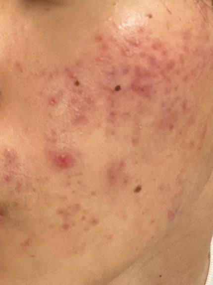 を使ったクチコミ(1枚目)